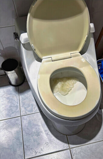 https://blockeddrainsinglewood.com.au/uploads/2025/07/blocked-toilet-27293.jpg